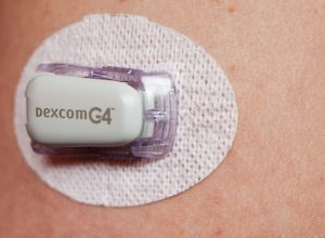 Diabetes technology - the Continuous Glucose Monitor Dexcom G4