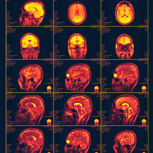 MRI Resonance Imaging is one of our examples of health informatics coming in the near future