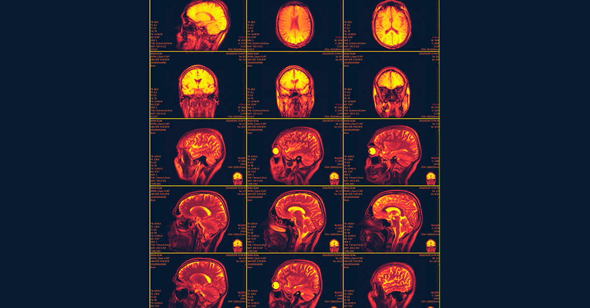 MRI Resonance Imaging is one of our examples of health informatics coming in the near future